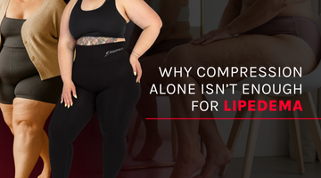 Why Compression Alone Isn’t Enough for Lipedema